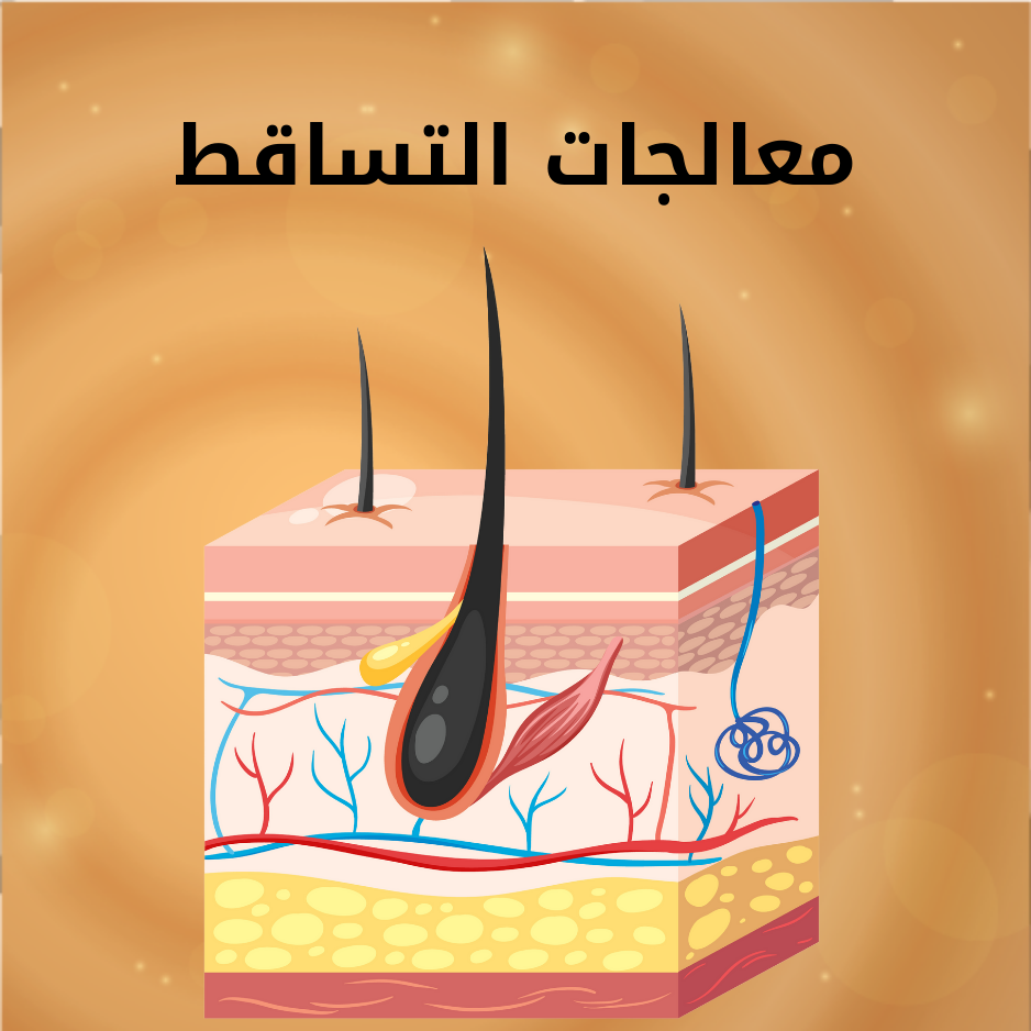 معالجات التساقط